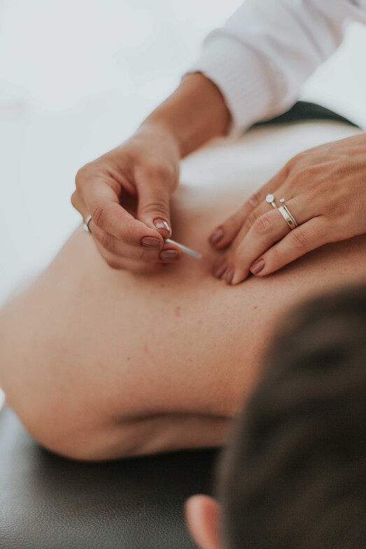 Chiropractic Acupuncture Dartmouth | Spring Physiotherapy 